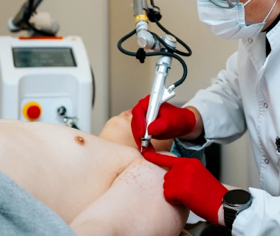 Laser dermatology for healthier skin